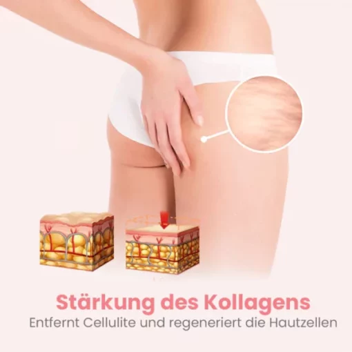 Oveallgo™ BootyBoost AntiAkne Peeling Natürliche Seife - Image 5