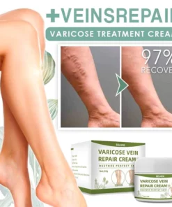 Varicose Treatment Cream