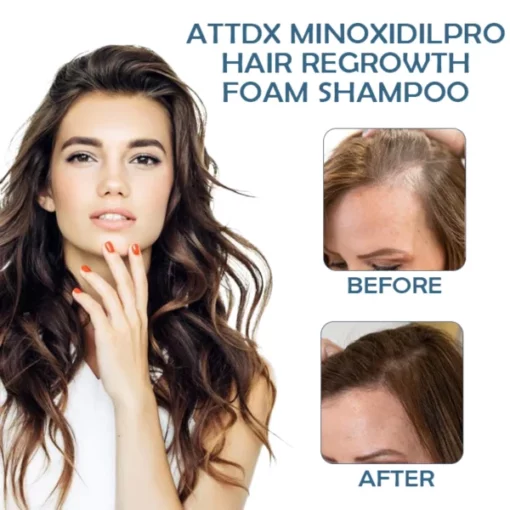 ATTDX MinoxidilPro HairRegrowth FoamShampoo - Image 8