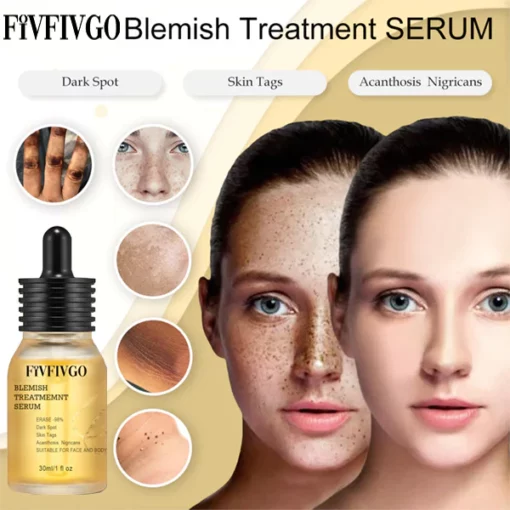 Fivfivgo™ Blemish Treatment Serum für dunkle Flecken & Acanthosis Nigricans & Skin Tag - Image 2