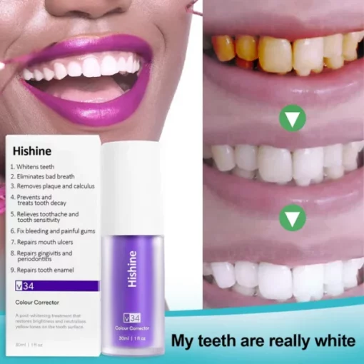 Oveallgo™ Pure Herbal Teeth Whitening Mousse - Image 5