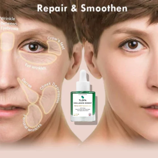 TLOPA 2023 Fortgeschrittenes Kollagen-Boost Anti-Aging-Serum🔥🔥【 Zeitlich begrenzter Rabatt Letzte 20 Minuten】 - Image 7