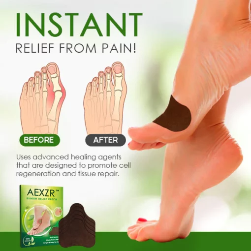 AEXZR™ Bunion Relief Patch - Image 4