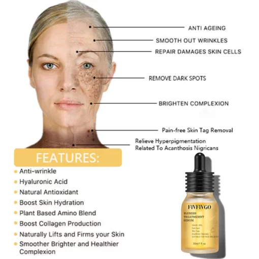 Fivfivgo™ Blemish Treatment Serum für dunkle Flecken & Acanthosis Nigricans & Skin Tag - Image 6