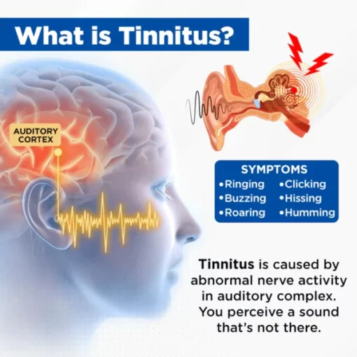 Suupillid™ AuriCalm Tinnitus Relief Device - Image 6