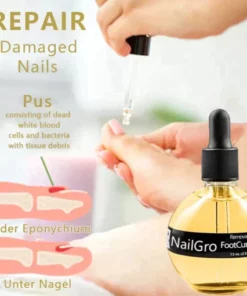 NailGro™ Intense Nail Growth and Strengthening Removal Paronychia Serum