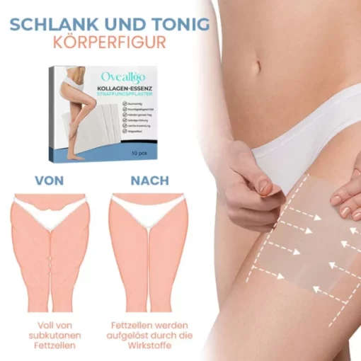 Oveallgo™ Zelle Straffen Anti-Cellulite Kollagen-Straffungspflaster - Image 6