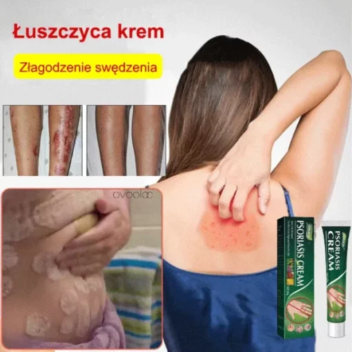 Universal Intense Psoriasis Skin Cream - Image 6