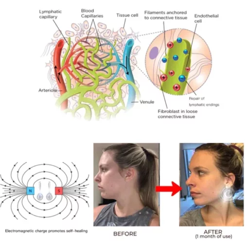 RKOL™ Lymphatic Magnetic Therapy Earrings - Image 6