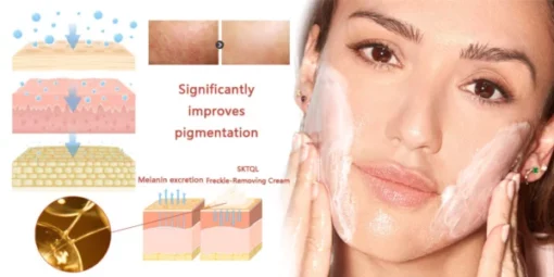 SKTQL™ Freckle-Removing Cream - Image 6