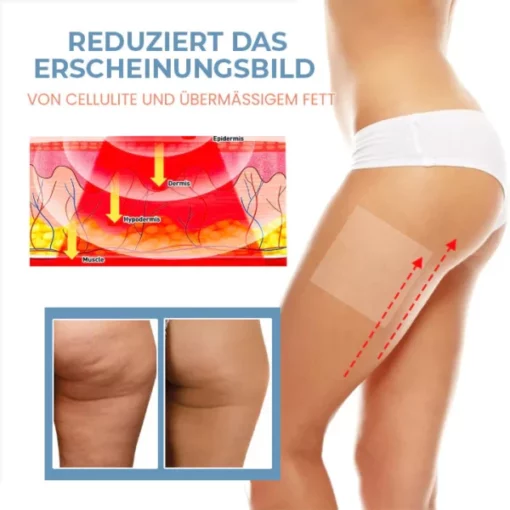 Oveallgo™ Zelle Straffen Anti-Cellulite Kollagen-Straffungspflaster - Image 5