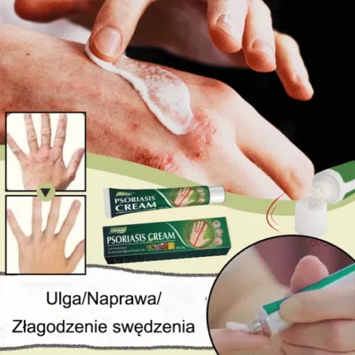 Universal Intense Psoriasis Skin Cream - Image 5