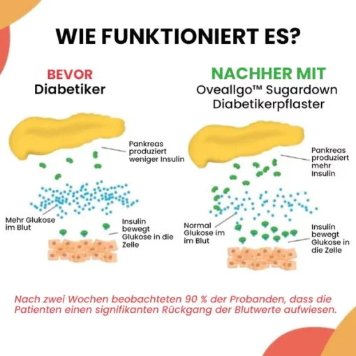 Oveallgo™ Sugardown Profi Diabetikerpflaster - Image 4