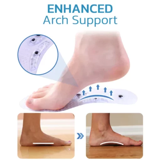 GFOUK™ Magnetic Acupressure Reflexology Insole - Image 5