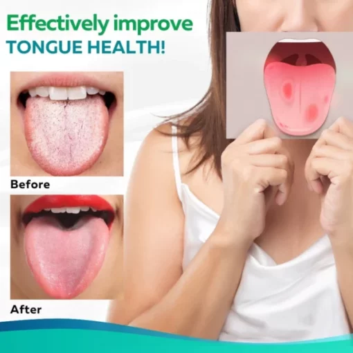 HealPlus™ Tongue Repair Spray - Image 6