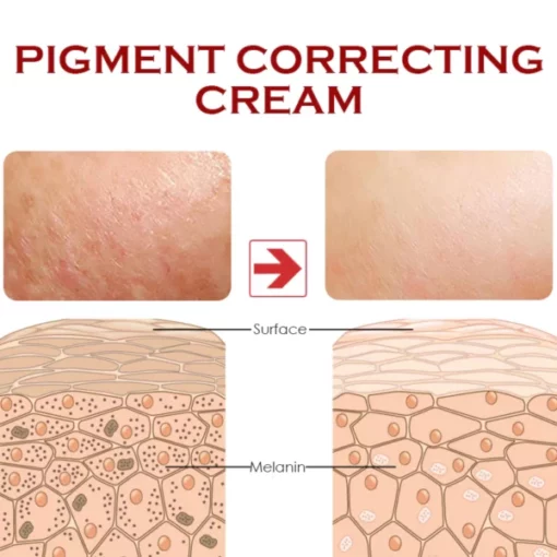 ATTDX DarkSpot PigmentCorrector Cream - Image 5