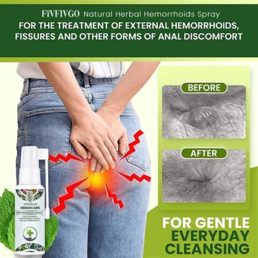 Fivfivgo™ Hemocare Kräuter-Hämorrhoidenspray - Image 4