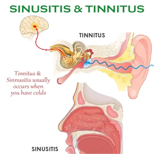 ATTDX Instant TinnitusReduce Relief Nasal Inhaler - Image 5