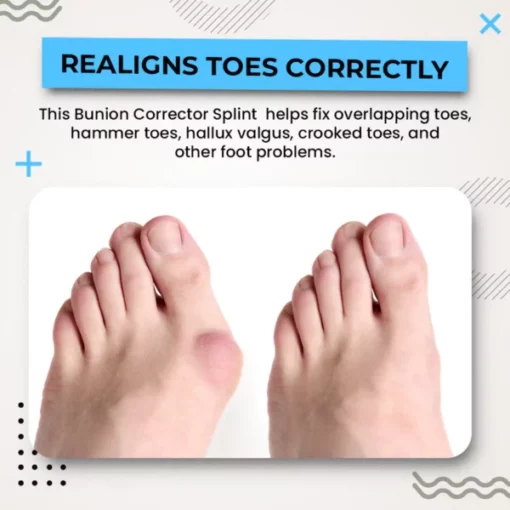 Suupillid™ 3D Instant Bunion Splint - Image 4