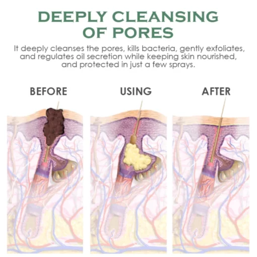 ATTDX BodyAcne Removal Cleanser Spray - Image 9