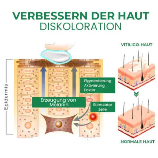 Fivfivgo™ VitiligoFix Revitalisierendes Elixier - Image 4