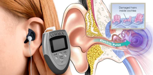 Luhaka™ Auracalm Electrotherapy Tinnitus Relief - Image 5