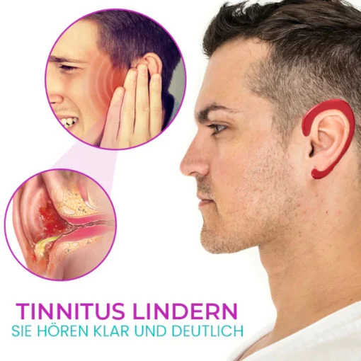 Oveallgo™ HearClear Tinnitus-Ohrlaser-Therapiegerät - Image 7