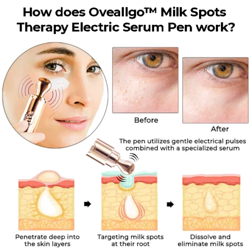 Oveallgo™ Milk Spots Therapy Electric Serum Pen - Image 5