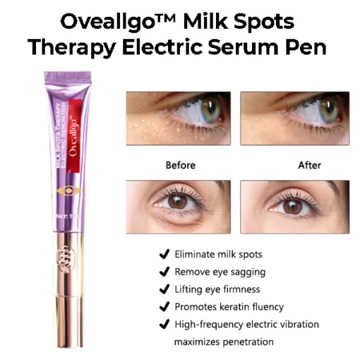 Oveallgo™ Milk Spots Therapy Electric Serum Pen - Image 4
