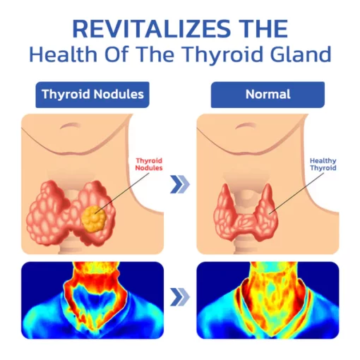 GFOUK™ ThyroidCare Anti-Schwellung Lymphatische Reinigungsrolle - Image 4