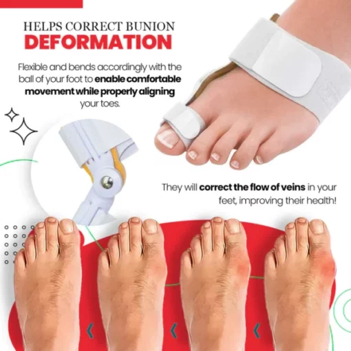 Ultracare™ Bunion Cream & Corrector Set - Image 5