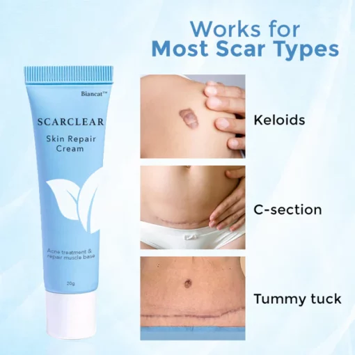 Biancat™ ScarClear Skin Repair Cream - Image 6