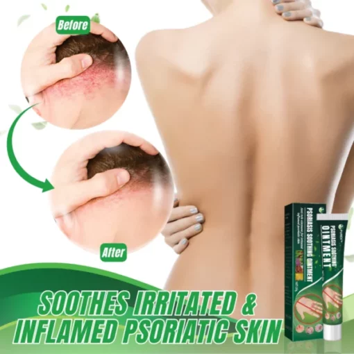 PUREX™ PSORIASIS SOOTHING OINTMENT - Image 5