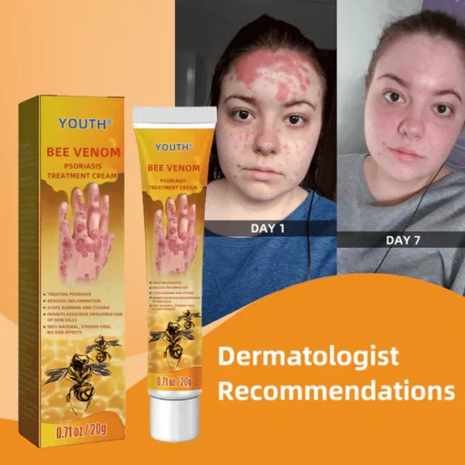 EdiJonah® Bee Venom Psoriasis Treatment Cream - Image 2