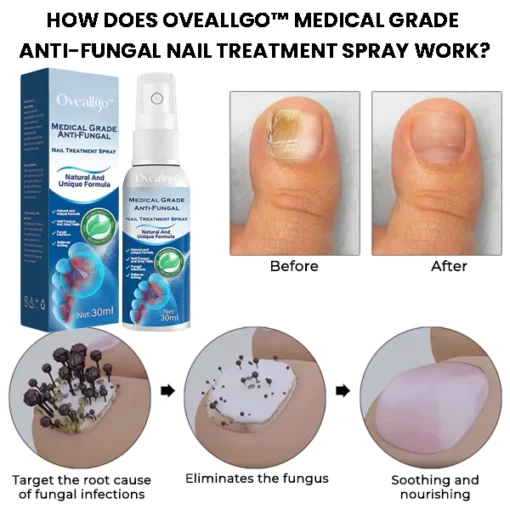 Oveallgo™ Medical Grade Anti-Fungal Nail Treatment Spray - Image 4