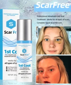 ScarFree™ Professional Advanced Cool Scar Treatment