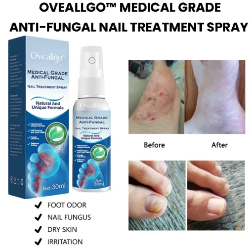 Oveallgo™ Medical Grade Anti-Fungal Nail Treatment Spray - Image 3