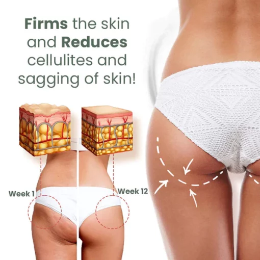 Fivfivgo™ Wormwood Cellulite AwayWith Skin Tightening Cream - Image 7