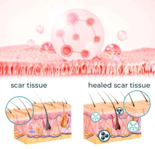 CNDB Bioskin™ Advanced Scar Removal Gel - Image 4