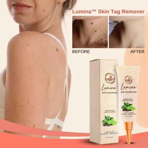 Lumina™ Skin Tag Remover - Image 3