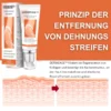 DERMEASE™ Creme zur Entfernung von Dehnungsstreifen