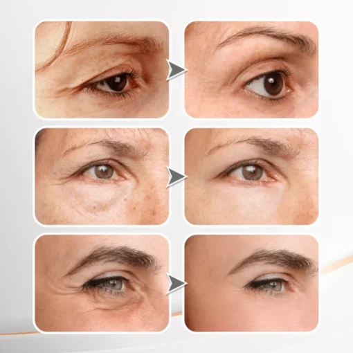 Biancat™ YouthfulLift Eye Firming Cream - Image 7