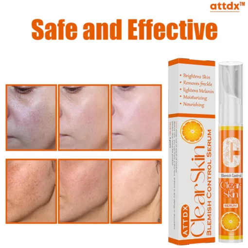 ATTDX ClearSkin Blemish Control Serum - Image 10