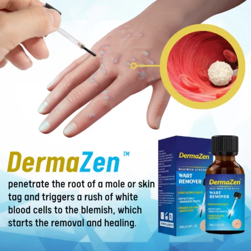 DermaZen™ Skin Tag Remover - Image 2