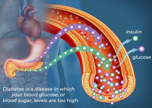 AQA™ SugarSync Health Control Aerosolizer - Image 11