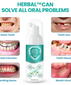 Herbal TEETHClean Mouthwash – Solve all Oral Problems