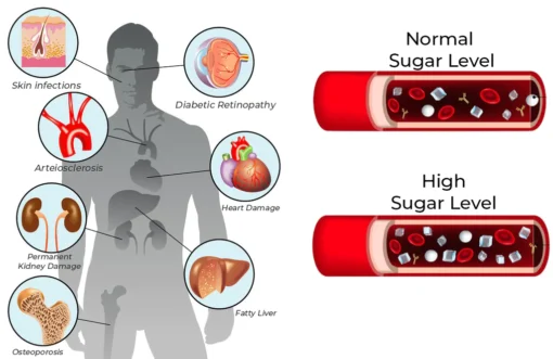 AQA™ SugarSync Health Control Aerosolizer - Image 10