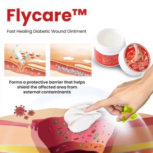 Flycare™ Fast Healing Diabetic Wound Ointment