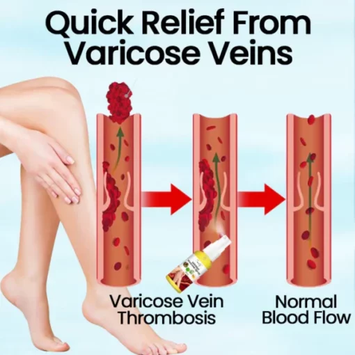 Ceoerty™ VeinMist Varicose Vein Spray - Image 7