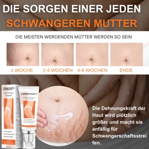 DERMEASE™ Creme zur Entfernung von Dehnungsstreifen - Image 5